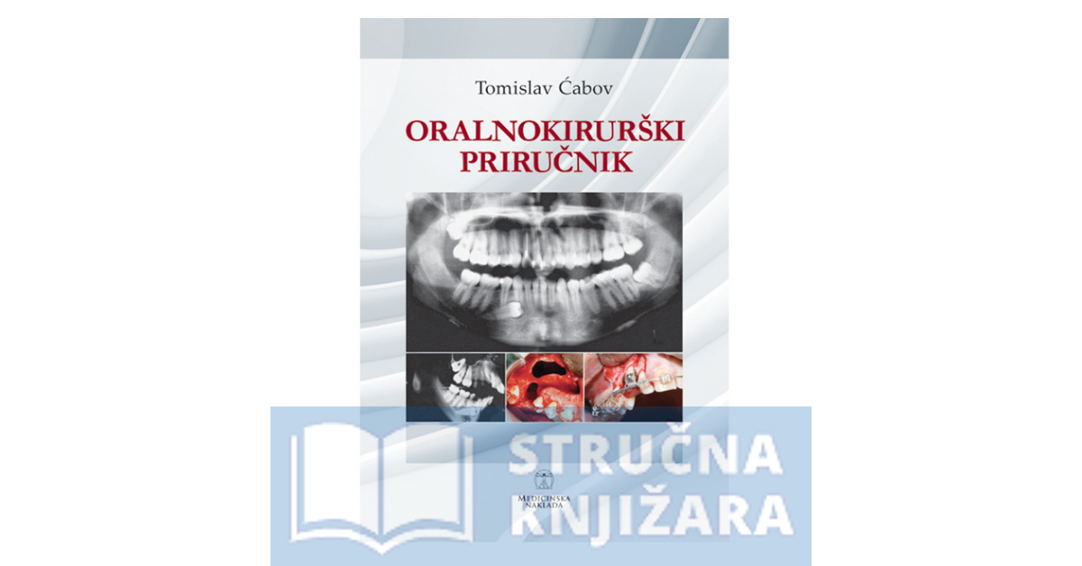 Oralnokirurški priručnik - Tomislav Ćabov