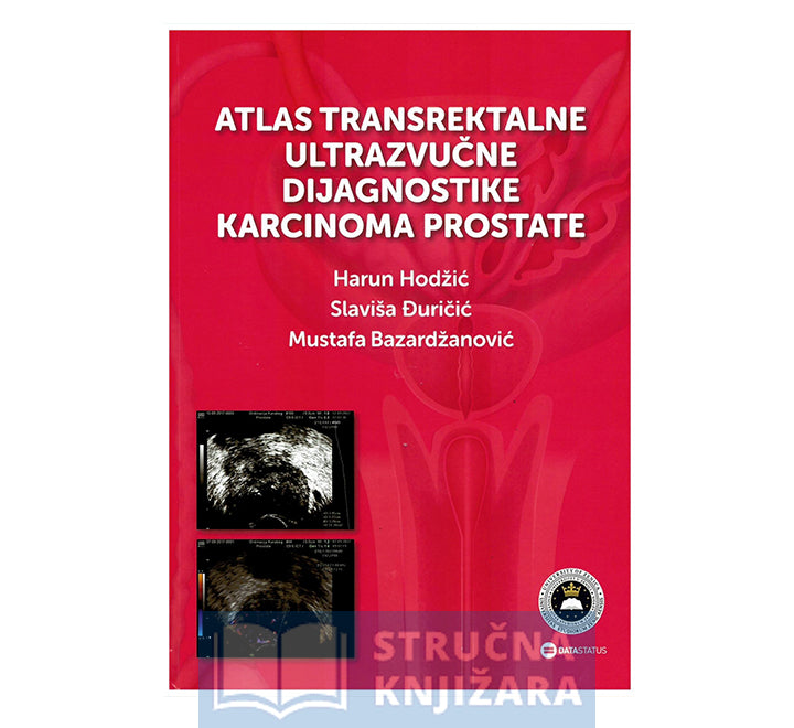 Atlas transrektalne ultrazvučne dijagnostike karcinoma prostate - Harun Hodžić, Slaviša Đuričić, Mustafa Bazardžanović