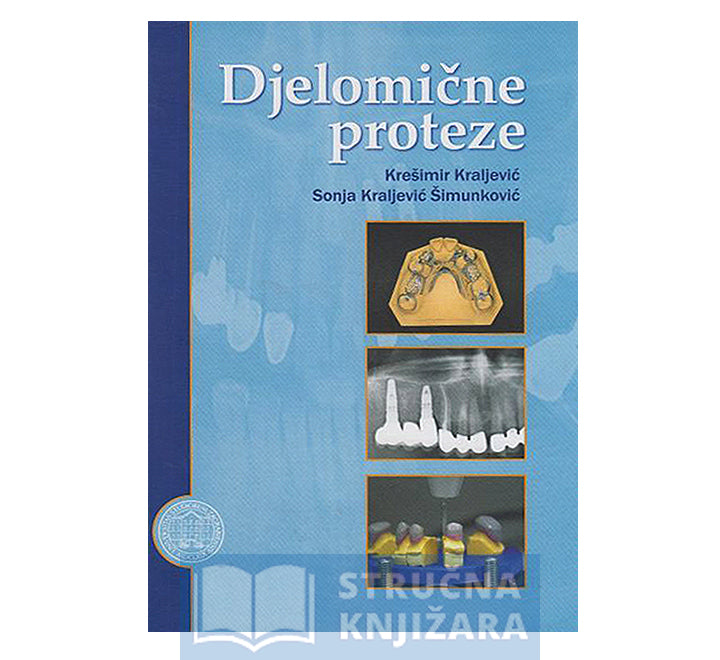 Djelomične proteze - Krešimir Kraljević, Sonja Kraljević Šimunković