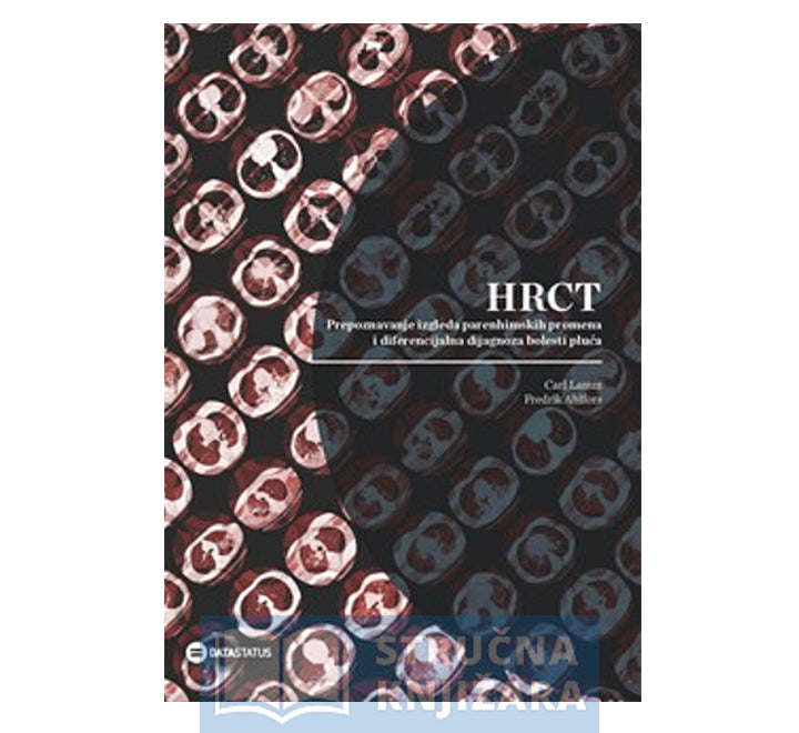 HRCT - Prepoznavanje izgleda parenhimskih promena i diferencijalna dijagnoza bolesti pluća - Carl Lamm, Fredrik Ahlfors