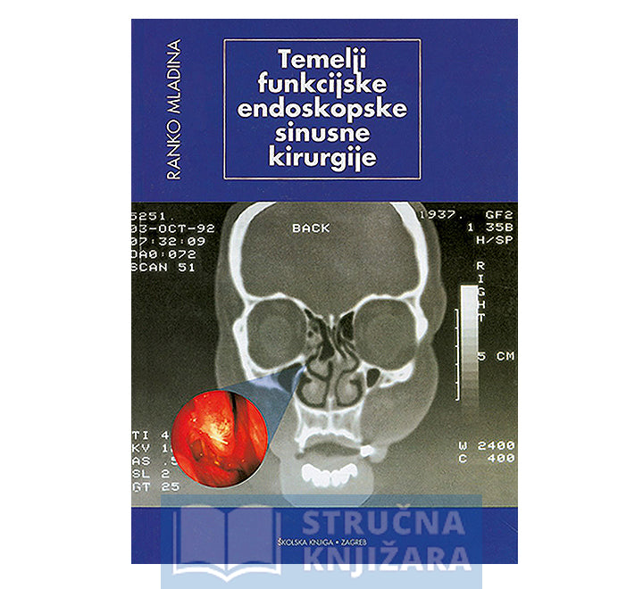 Temelji funkcijske endoskopske sinusne kirurgije - Ranko Mladina