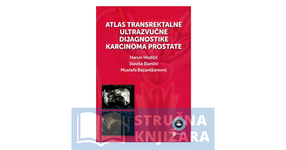 Atlas transrektalne ultrazvučne dijagnostike karcinoma prostate - Harun Hodžić, Slaviša Đuričić, Mustafa Bazardžanović