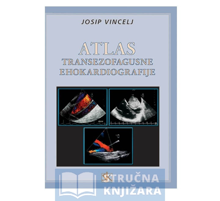 Atlas transezofagusne ehokardiografije - Josip Vincelj