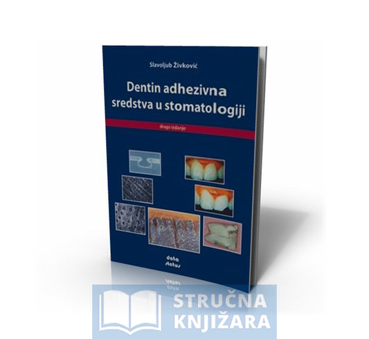 Dentin adhezivna sredstva u stomatologiji - autor: Slavoljub Živković