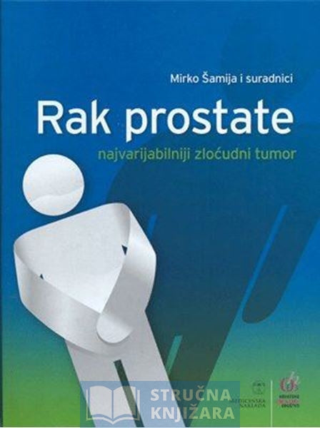 Rak prostate - Mirko Šamija i suradnici