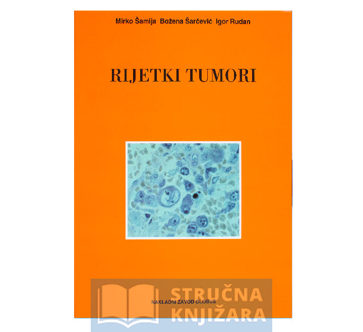 Rijetki tumori - Mirko Šamija, Božena Šarčević, Igor Rudan