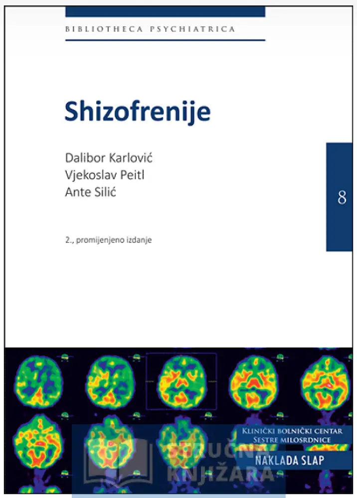 Shizofrenije - Dalibor Karlović Vjekoslav Peitl Ante Silić Drugo Promijenjeno I Dopunjeno Izdanje